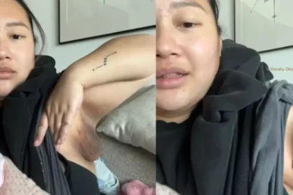 Mulher viraliza ao relatar terceiro seio durante amamentação; veja