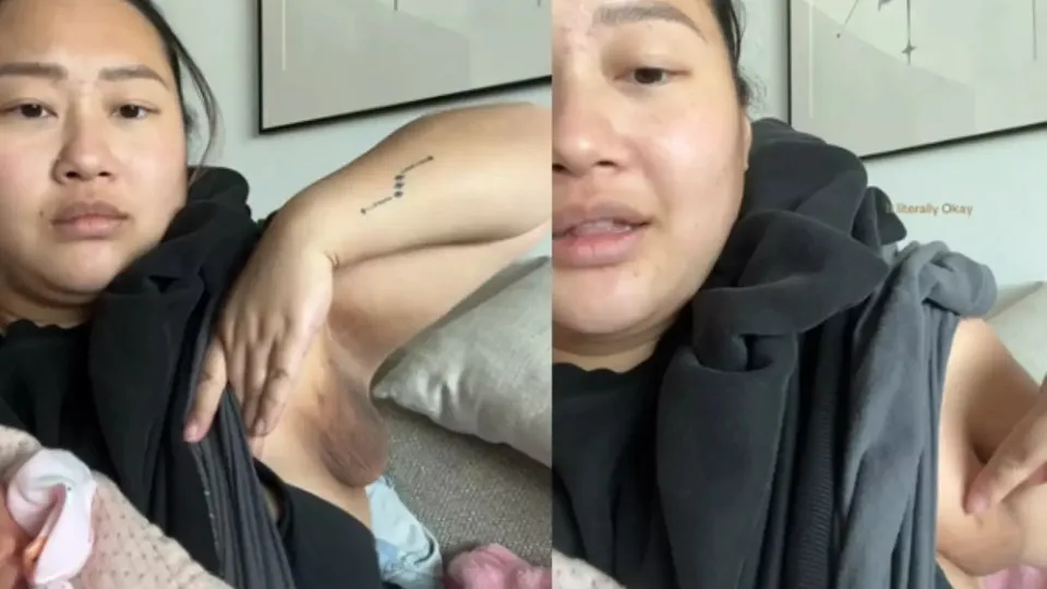 Mulher viraliza ao relatar terceiro seio durante amamentação; veja