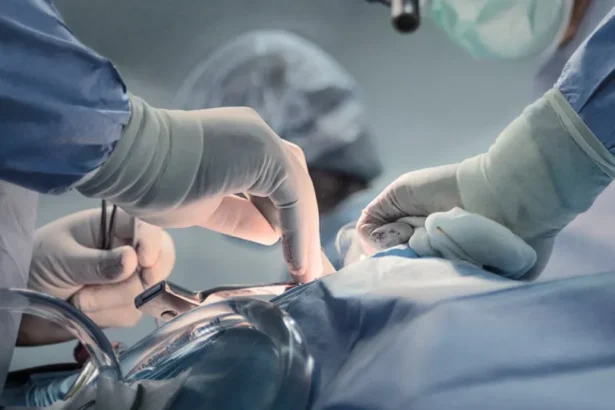 Gêmeos siameses morrem após cirurgia de separação em Goiânia