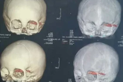 Cientistas acham crânios de 2.000 anos, e detalhe nos dentes chama atenção