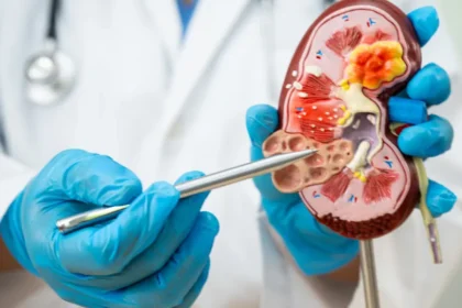 Doença renal avança no país e expõe gargalos de acesso à diagnóstico precoce e à diálise