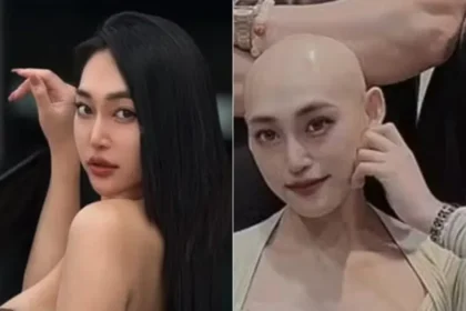 Influenciadora confunde câncer com lesão e morre aos 29 anos