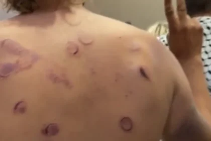 Hematomas e fraturas: ativistas da flotilha falam em tortura em Israel