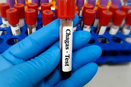 Risco cardíaco dobra para pacientes com doença de Chagas após cirurgia