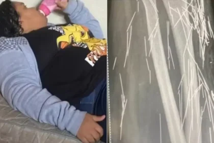 Mulher que fingiu ter 12 anos relatou agulhas no corpo