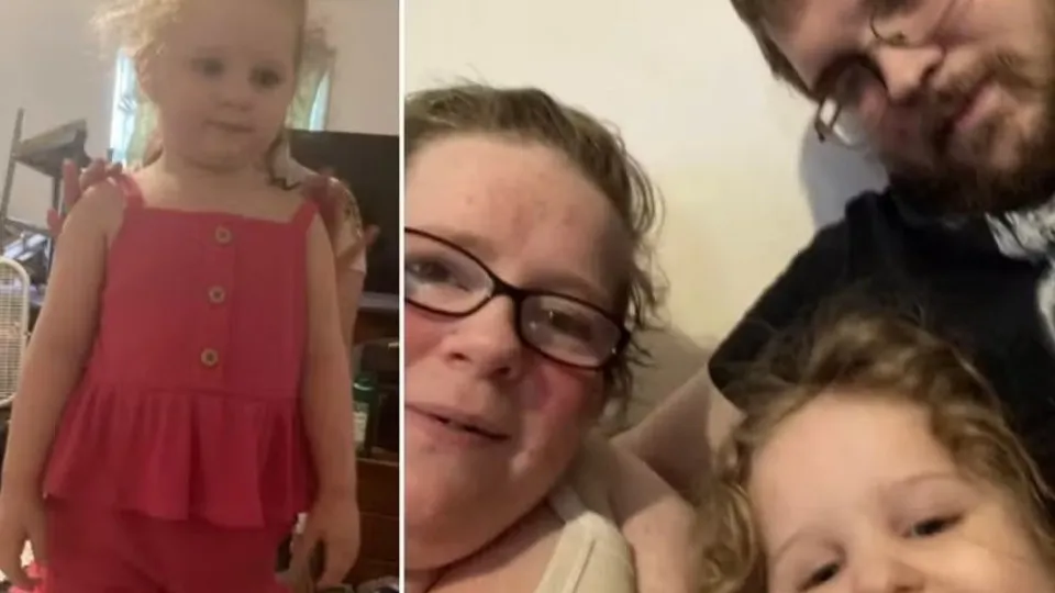 Casal é condenado após filha de 3 anos morrer de infestação de piolhos