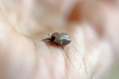 Mulher morre de febre maculosa no ABC; carrapatos foram encontrados em cães da vítima