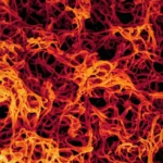 ebola