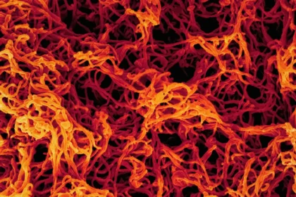 ebola