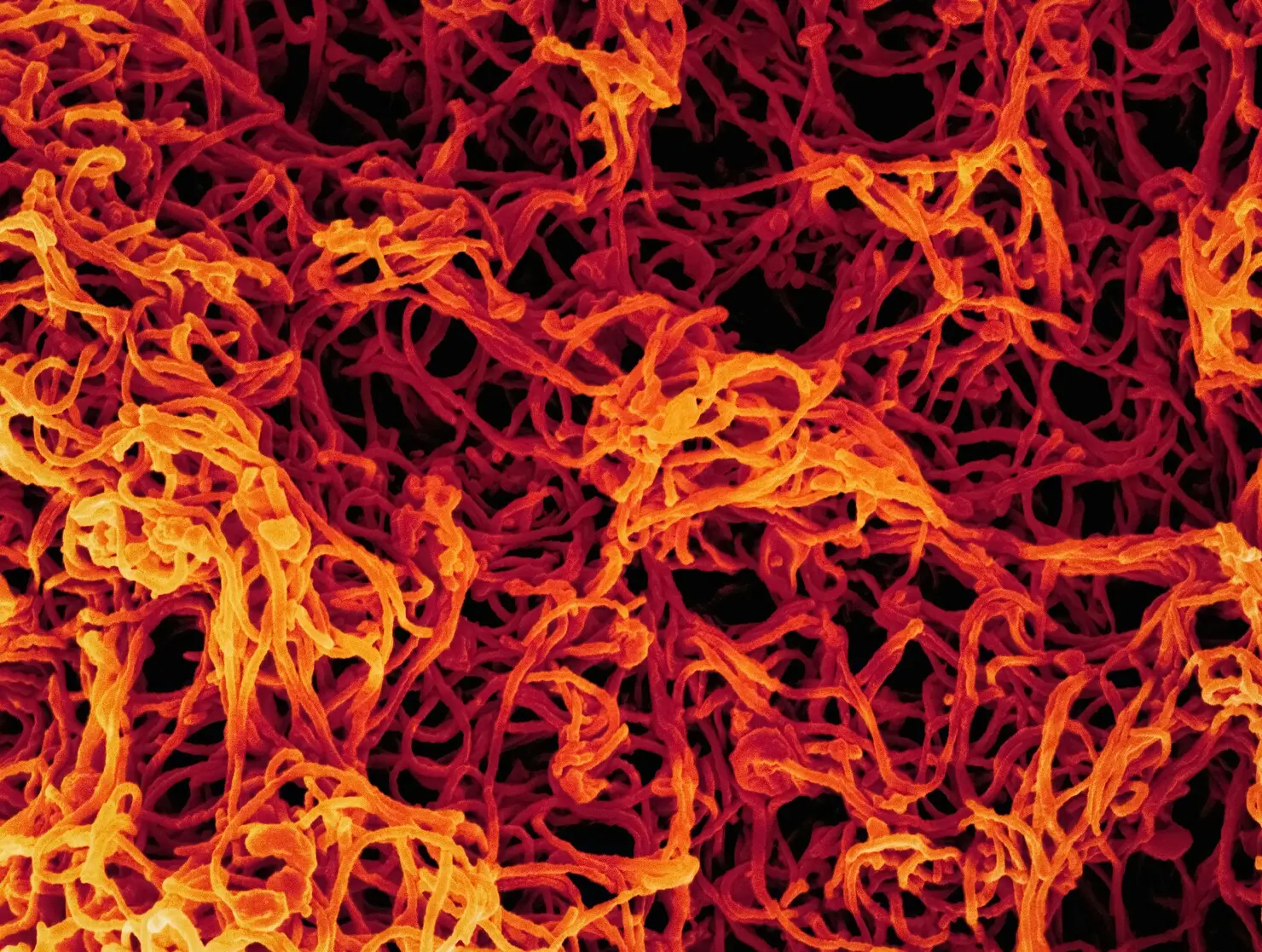 ebola